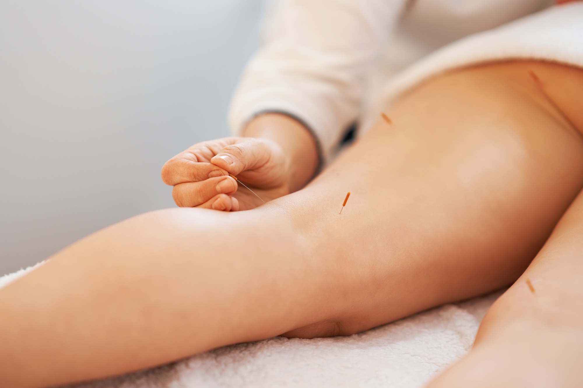 A acupuncture needle therapy in the studio