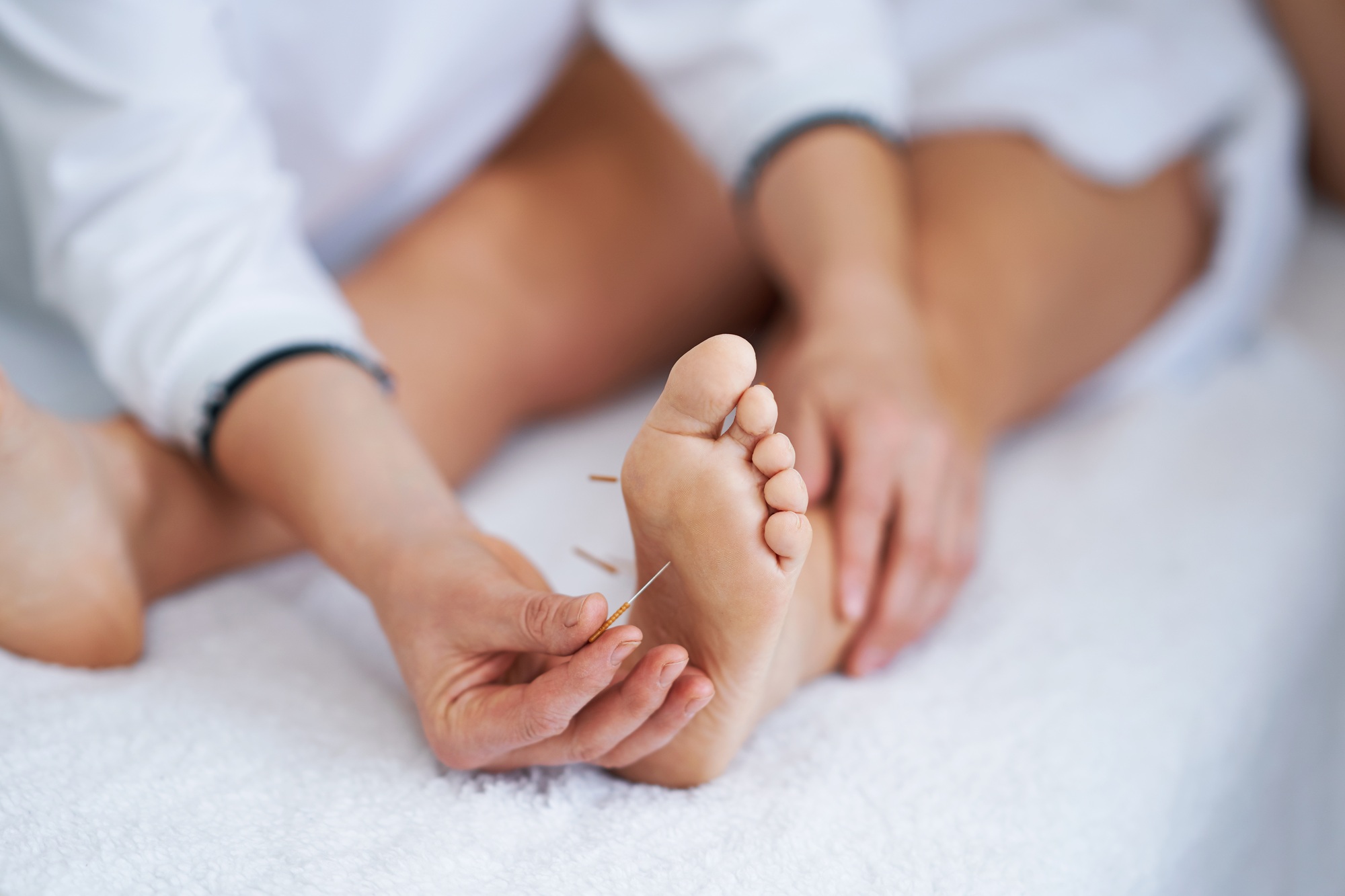 A acupuncture needle therapy in the studio